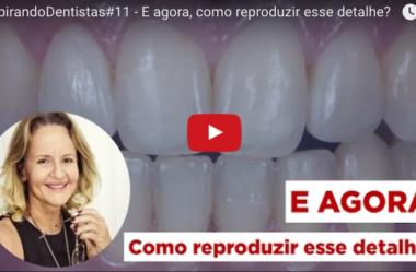 ID#11 – E agora, como reproduzir esse detalhe?